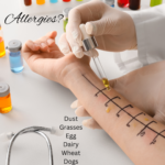 Allergy testing - more than meets the eye